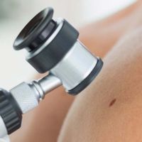 dermatoskopia